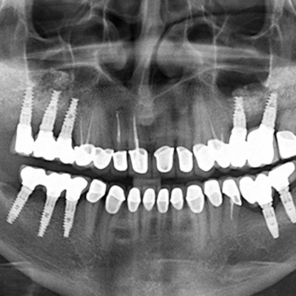 عکس CBCT چیست؟