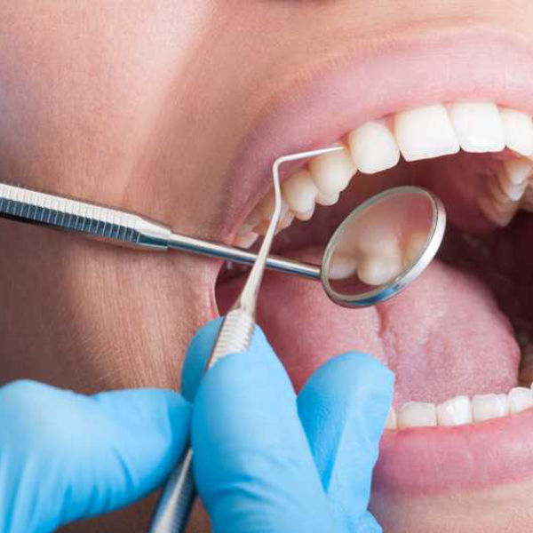 teeth-bleaching-in-patients-with-dental-sensitivity