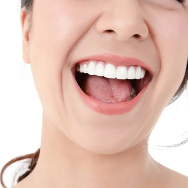 teeth-whitening-at-home