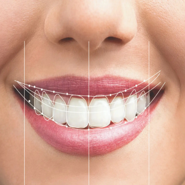 golden-secrets-to-having-a-beautiful-smile-and-healthy-teeth