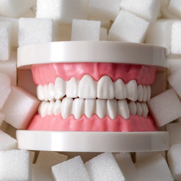 the-impact-of-diabetes-on-the-health-of-teeth-and-gums