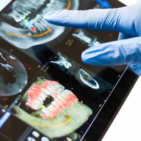 what-is-a-digital-implant