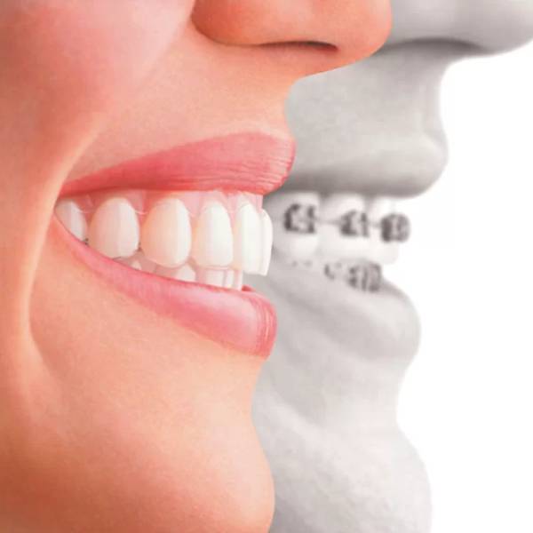 the-best-orthodontist-in-tehran