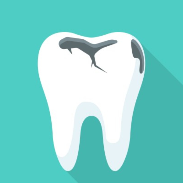 can a decayed tooth be repaired