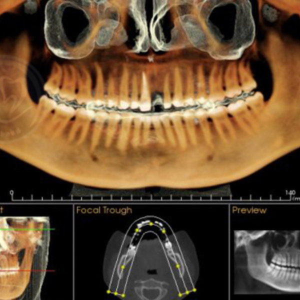 cbct-image2