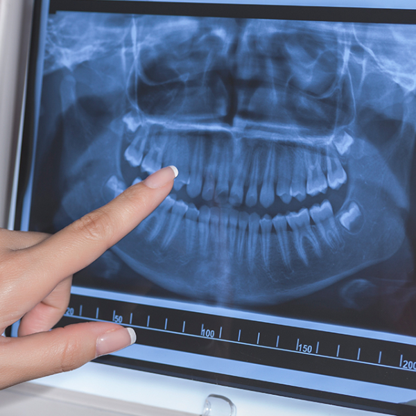 dental-x-ray2