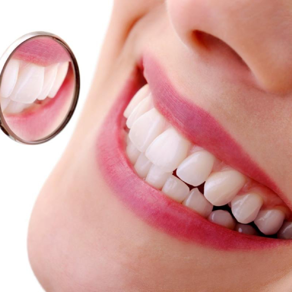 teeth-bleaching-in-patients-with-dental-sensitivity