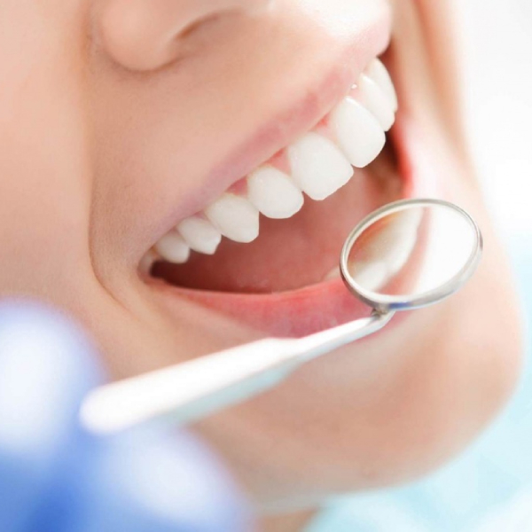 teeth-bleaching-in-patients-with-dental-sensitivity2