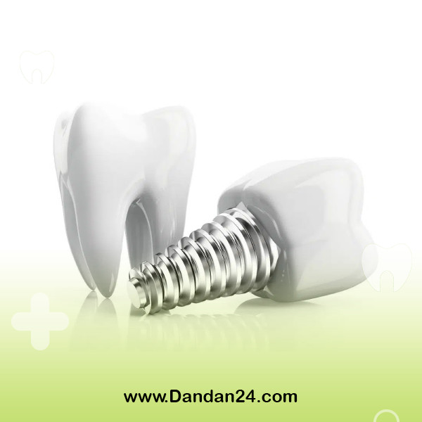 age-limit-for-dental-implant-placement2