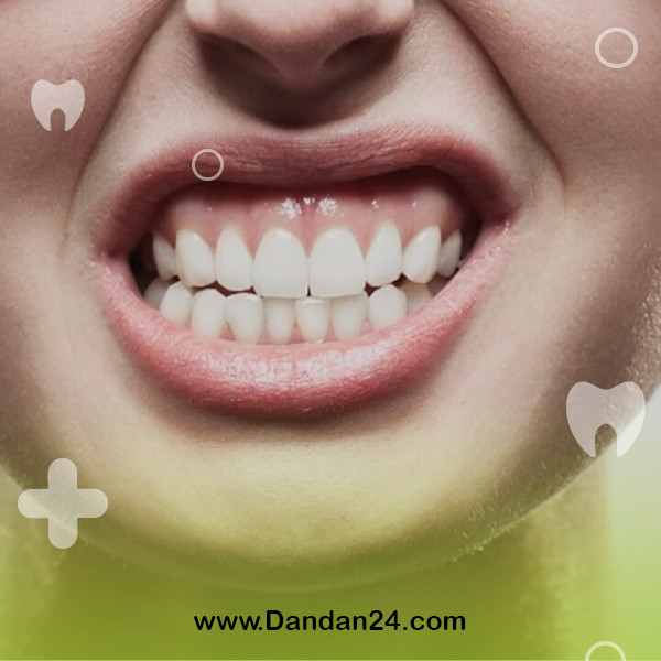 All about teeth grinding