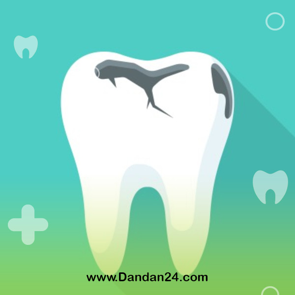 can a decayed tooth be repaired