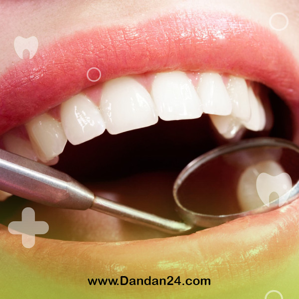 care-after-tooth-filling