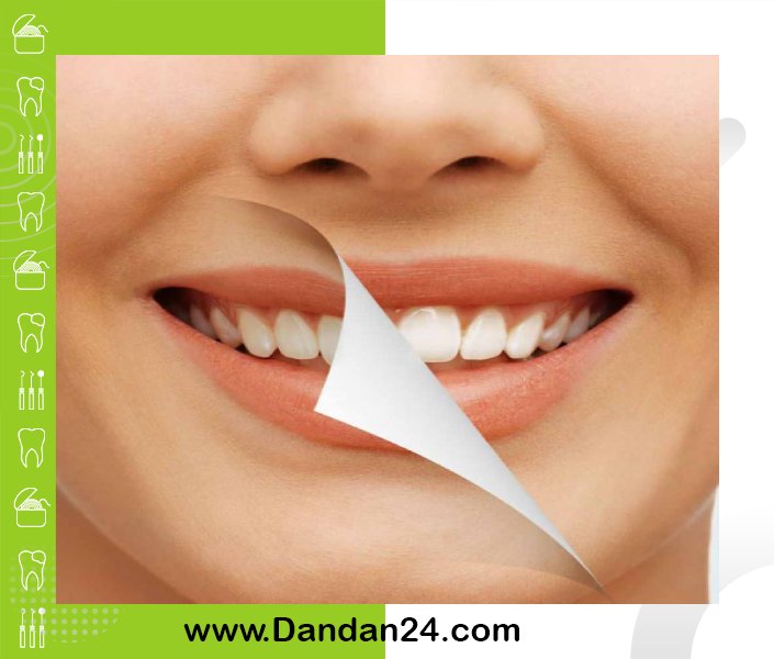 دندان پزشکی زیبایی: چگونه لبخند خود را به راحتی تغییر دهید؟
