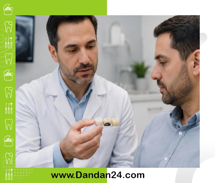 روکش دندان چیست و در چه شرایطی بهترین انتخاب درمانی است؟