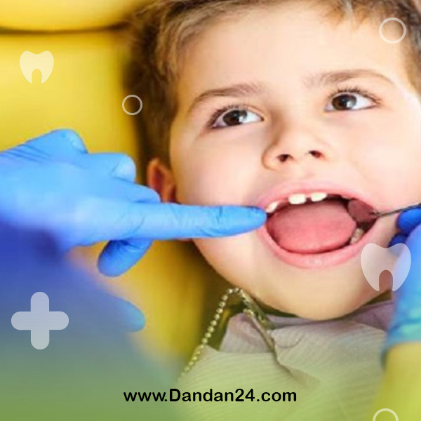 dental-implants-in-children-and-teenagers2