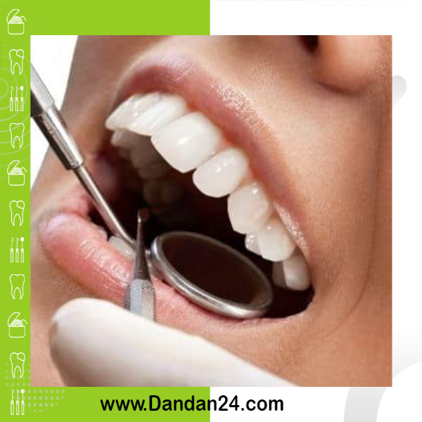 مراقبت از لمینت دندان: نکات مهم