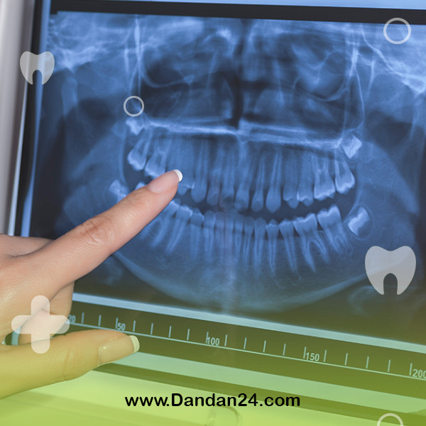 dental-x-ray2