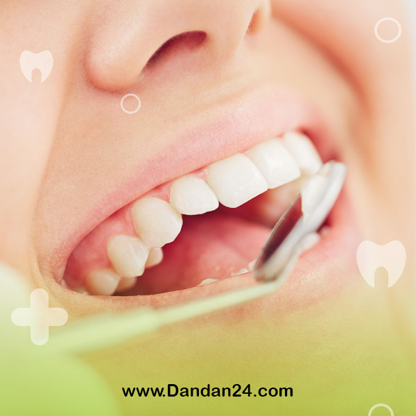 does-scaling-thin-the-tooth2