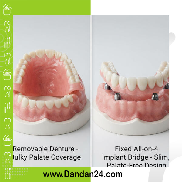 fixed-vs-removable-dentures-comparison