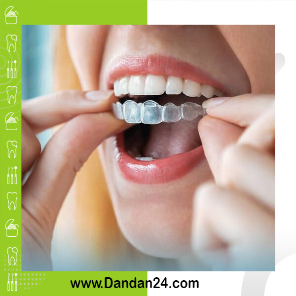 ارتودنسی نامرئی چیست؟ هزینه، روند درمان و مزایا