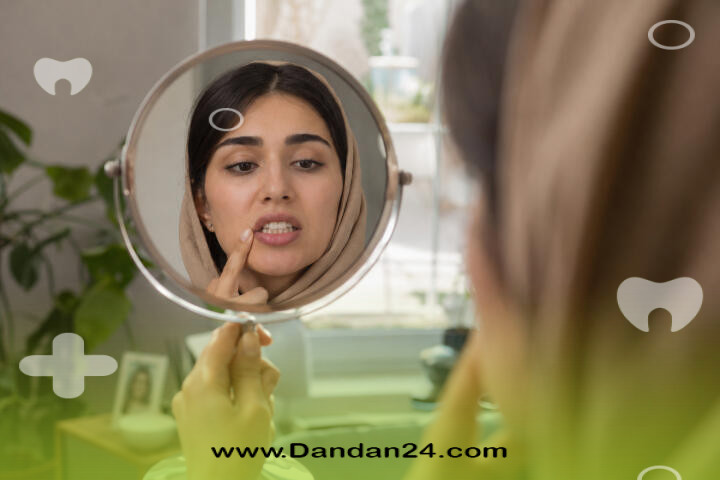 لمینت و کامپوزیت چه تفاوتی دارند؟