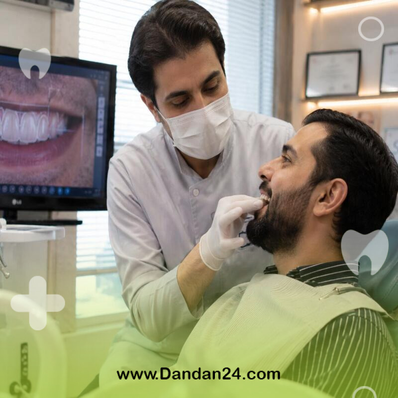 ماندگاری لیمینیت بیشتر است یا کامپوزیت؟