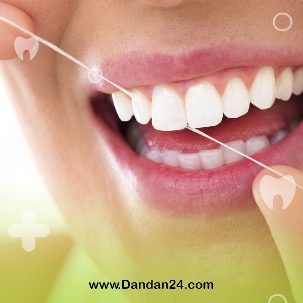 laminated-tooth-scaling