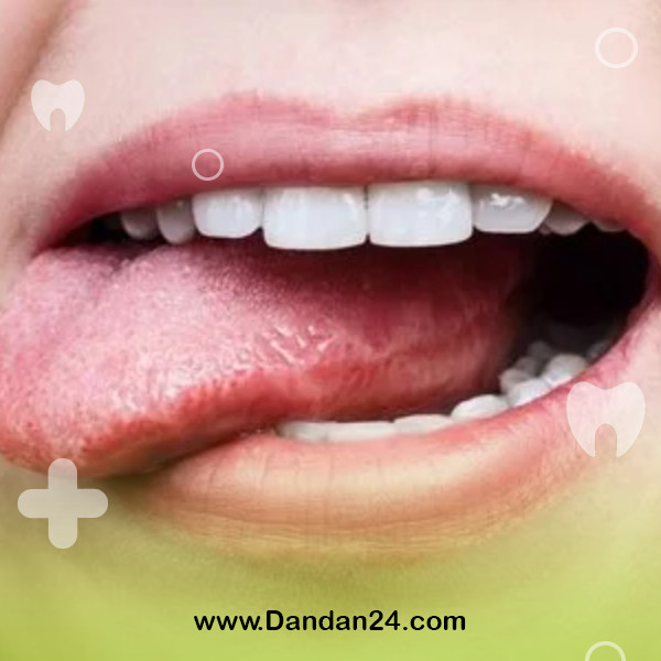 oral-cancer2