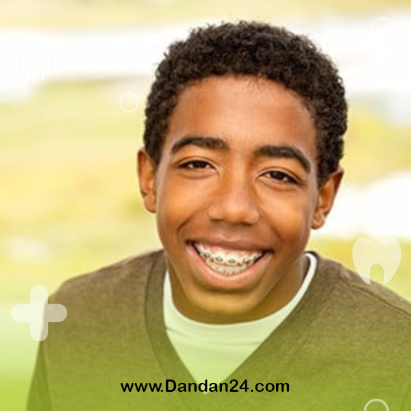 orthodontics-in-adolescence