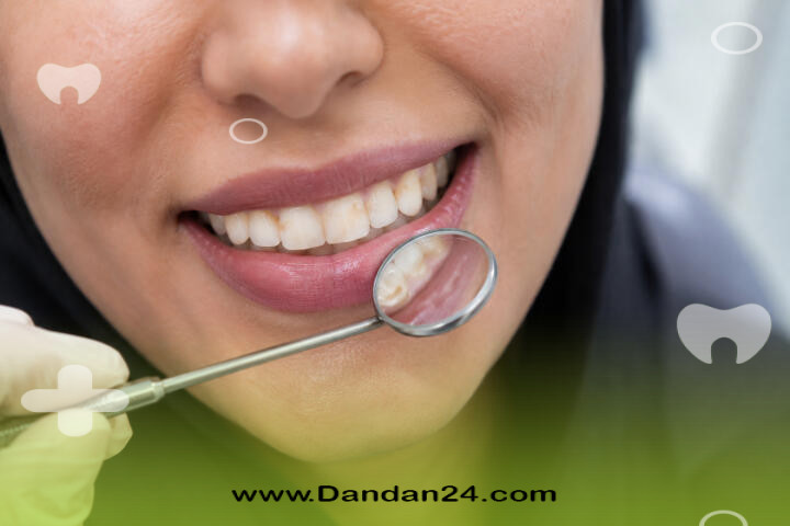 اشتباهات رایج بیماران هنگام انتخاب بین جرمگیری و بلیچینگ