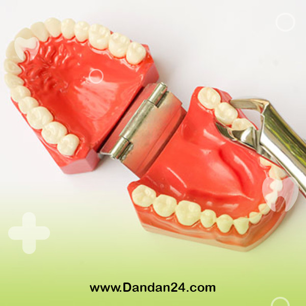 solutions-to-prevent-the-need-for-tooth-extraction2