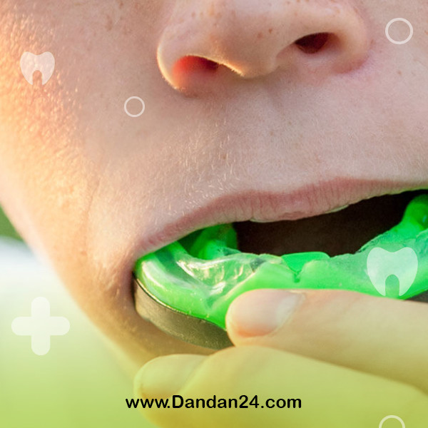 sports-injuries-and-dental-care2