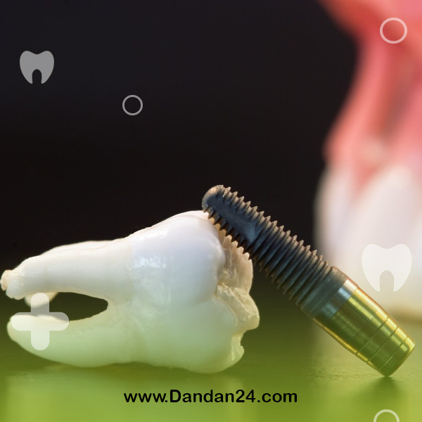 swelling-after-dental-implant