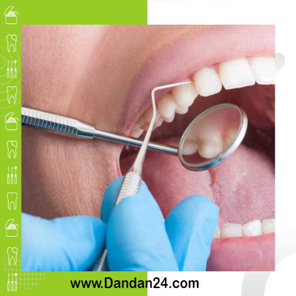 بلیچینگ دندان در بیماران دارای حساسیت دندانی