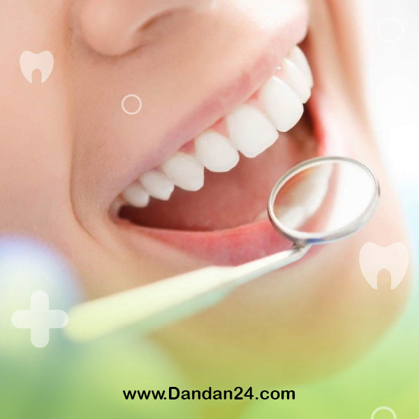 teeth-bleaching-in-patients-with-dental-sensitivity2