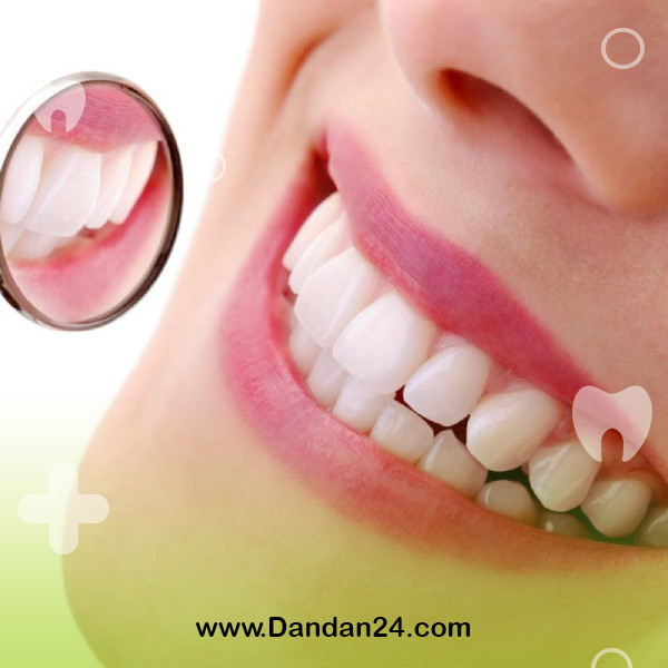 teeth-bleaching-in-patients-with-dental-sensitivity