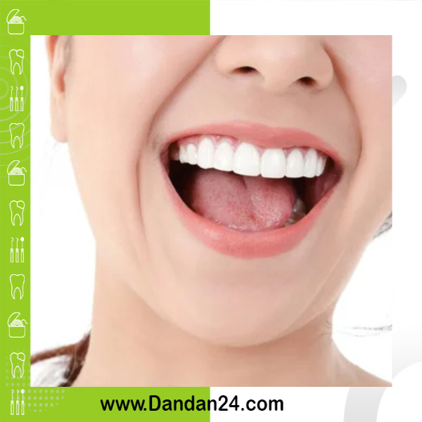 10 روش طبیعی برای سفید کردن دندان ها در خانه