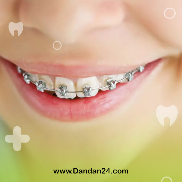 the-best-age-for-orthodontics