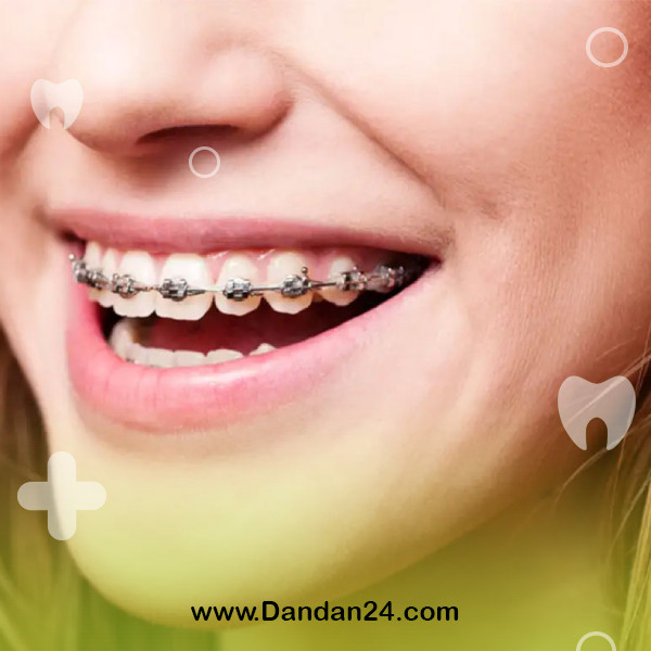 the-best-age-for-orthodontics2