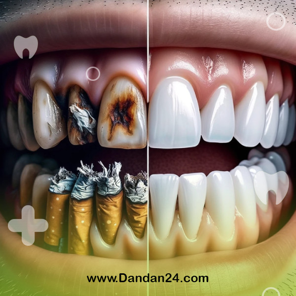 the-effect-of-smoking-on-oral-health