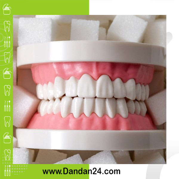 تأثیر دیابت بر سلامت دندان ها و لثه ها