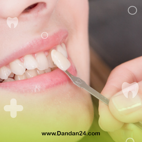 tooth-sensitivity-after-laminate2