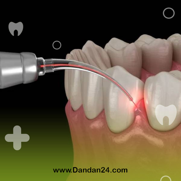 types-of-gum-surgery-and-the-use-of-each