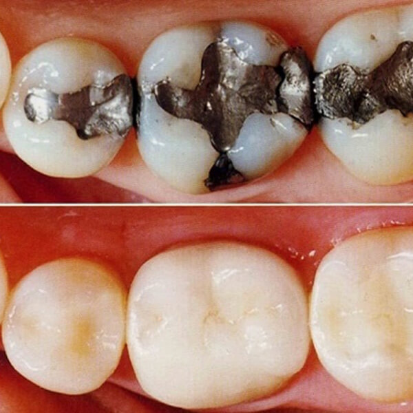 معرفی بهترین کلینیک دندانپزشکی در غرب تهران توسط دندان 24