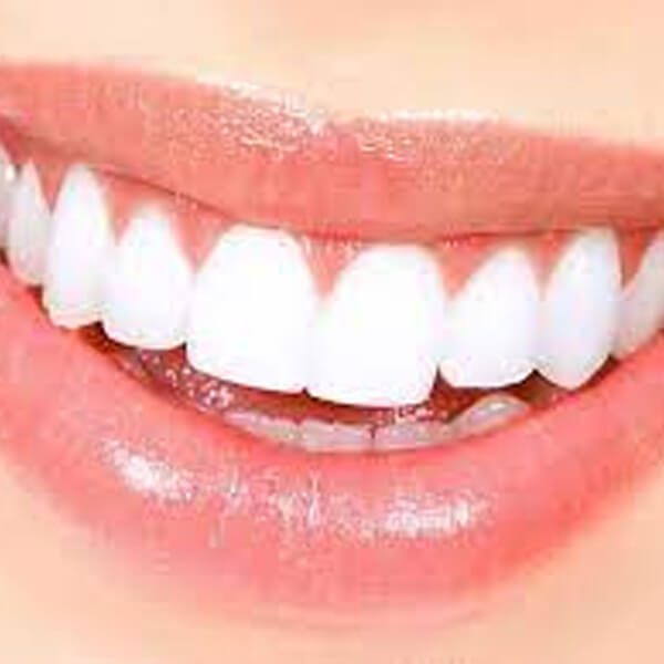 معایب ایمپلنت دندان